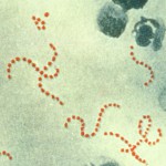 人食いバクテリア特集：溶血性レンサ球菌やグラム陰性桿菌が起こす壊死性筋膜炎の恐怖
