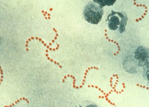 人食いバクテリア特集：溶血性レンサ球菌やグラム陰性桿菌が起こす壊死性筋膜炎の恐怖
